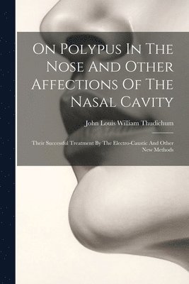 On Polypus In The Nose And Other Affections Of The Nasal Cavity 1