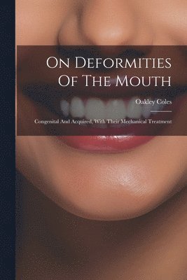 bokomslag On Deformities Of The Mouth