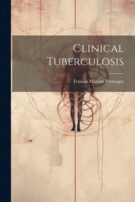 Clinical Tuberculosis 1