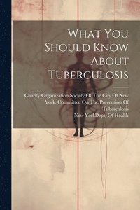 bokomslag What You Should Know About Tuberculosis