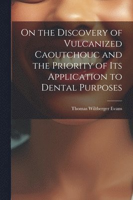 On the Discovery of Vulcanized Caoutchouc and the Priority of its Application to Dental Purposes