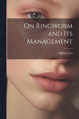 On Ringworm and Its Management 1