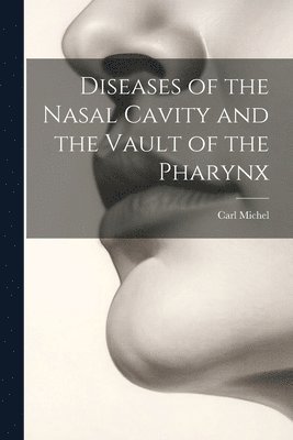 Carl Michel - Diseases of the Nasal Cavity and the Vault of the Pharynx, Häftad