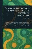 bokomslag Graphic Illustrations of Abortion and the Diseases of Menstruation