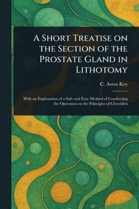 bokomslag Short Treatise on the Section of the Prostate Gland in Lithotomy