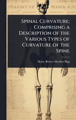 bokomslag Spinal Curvature; Comprising a Description of the Various Types of Curvature of the Spine