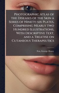 bokomslag Photographic Atlas of the Diseases of the Skin a Series of Ninety-six Plates, Comprising Nearly two Hundred Illustrations, With Descriptive Text, and