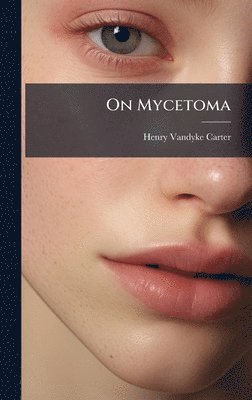 Henry Vandyke Carter - On Mycetoma, Inbunden