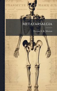 bokomslag Metatarsalgia