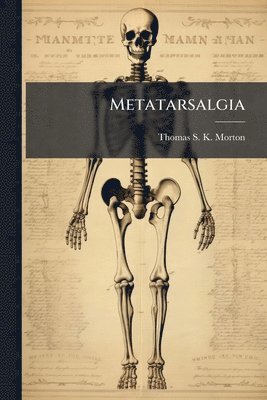 bokomslag Metatarsalgia