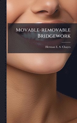 bokomslag Movable-removable Bridgework
