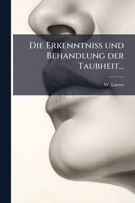 bokomslag Erkenntniss und Behandlung der Taubheit...