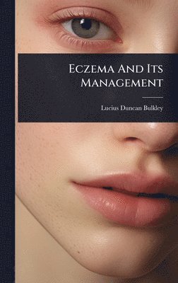 bokomslag Eczema And Its Management