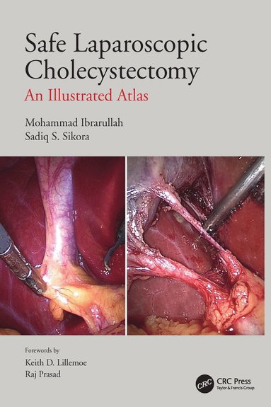 bokomslag Safe Laparoscopic Cholecystectomy