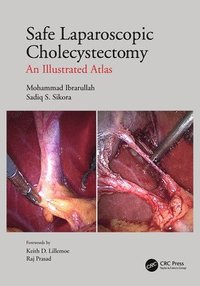 bokomslag Safe Laparoscopic Cholecystectomy