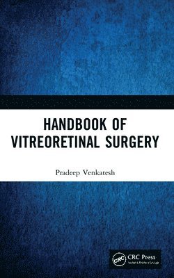 Handbook of Vitreoretinal Surgery 1