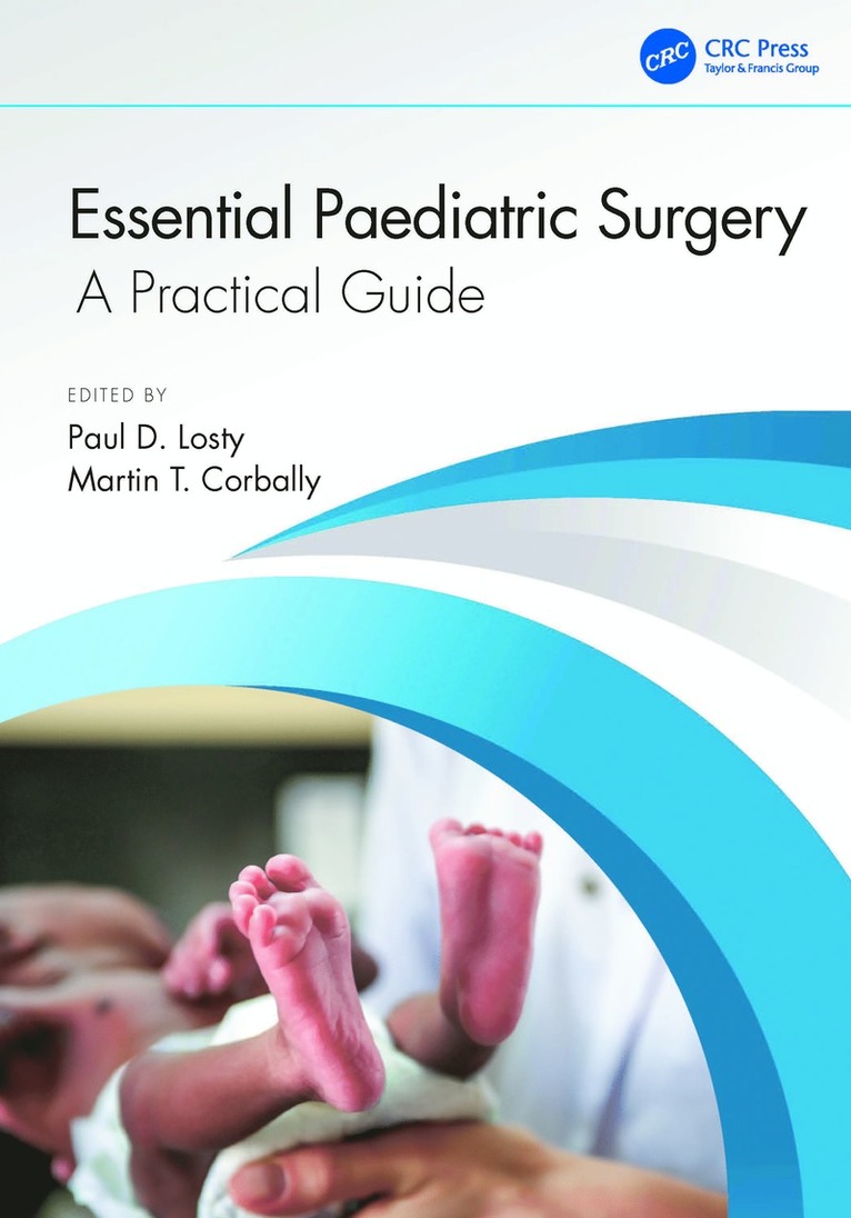 Essential Paediatric Surgery