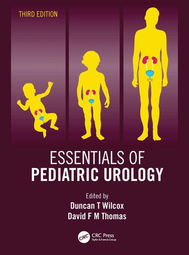 Duncan T Wilcox, David F M Thomas - Essentials of Pediatric Urology, Inbunden