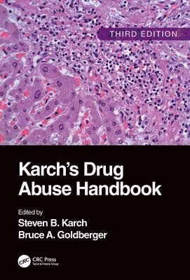 Steven B. Karch, Bruce A. Goldberger, FFFLM Karch, Steven B., MD, USA) Goldberger, Bruce A. (MD, FFFLM, FFSSoc, Consultant Cardiac Pathologist and Toxicologist, Berkeley, California - Karch's Drug Abuse Handbook, Häftad