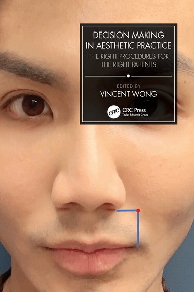 Vincent Wong - Decision Making in Aesthetic Practice, Inbunden