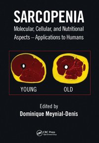 bokomslag Sarcopenia