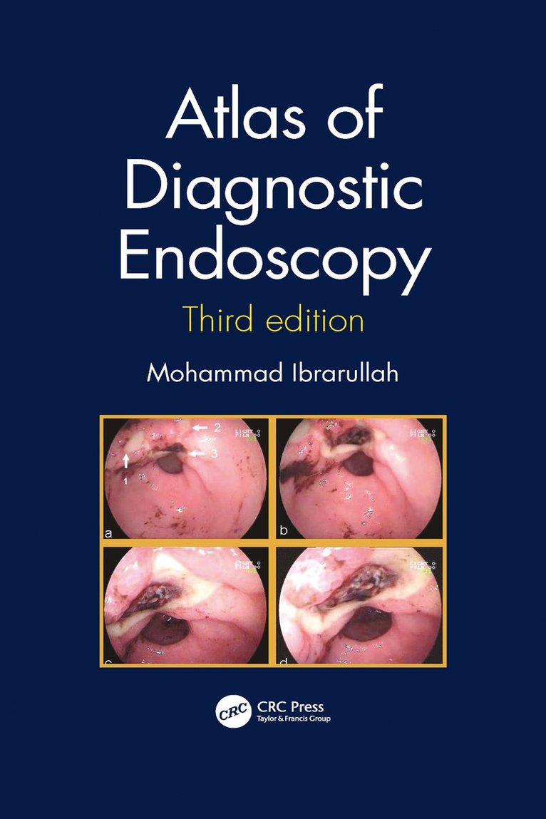 Atlas of Diagnostic Endoscopy, 3E 1