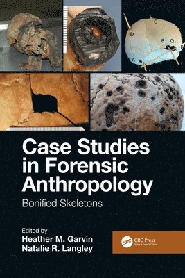 Case Studies in Forensic Anthropology 1
