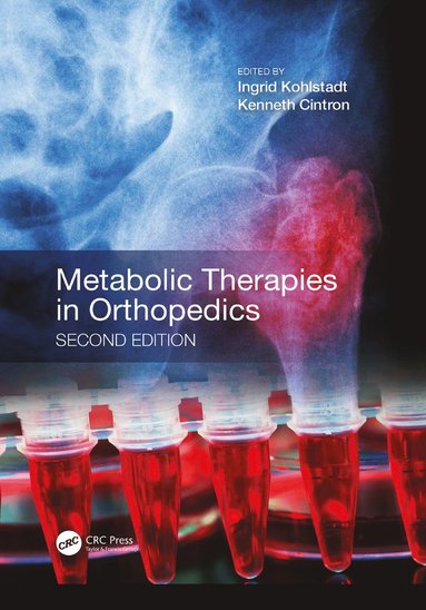 bokomslag Metabolic Therapies in Orthopedics, Second Edition