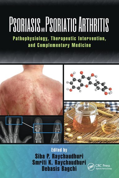 bokomslag Psoriasis and Psoriatic Arthritis