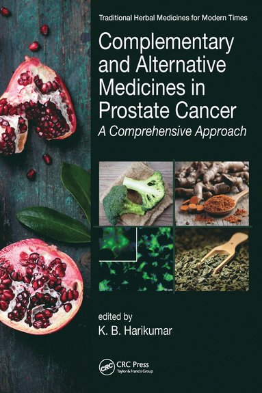 bokomslag Complementary and Alternative Medicines in Prostate Cancer