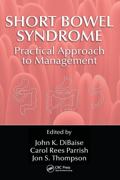 John K. DiBaise, Carol Rees Parrish, Jon S. Thompson - Short Bowel Syndrome, Häftad