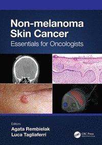 bokomslag Non-melanoma Skin Cancer