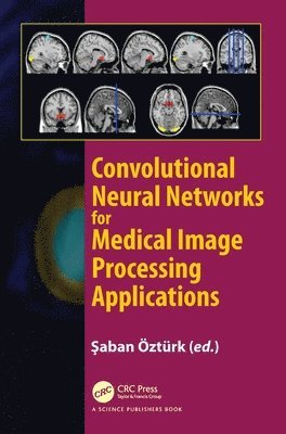 Convolutional Neural Networks for Medical Image Processing Applications 1