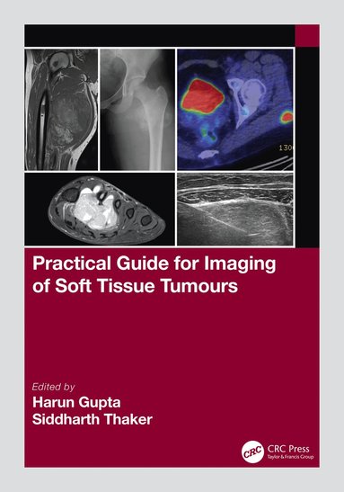 bokomslag Practical Guide for Imaging of Soft Tissue Tumours