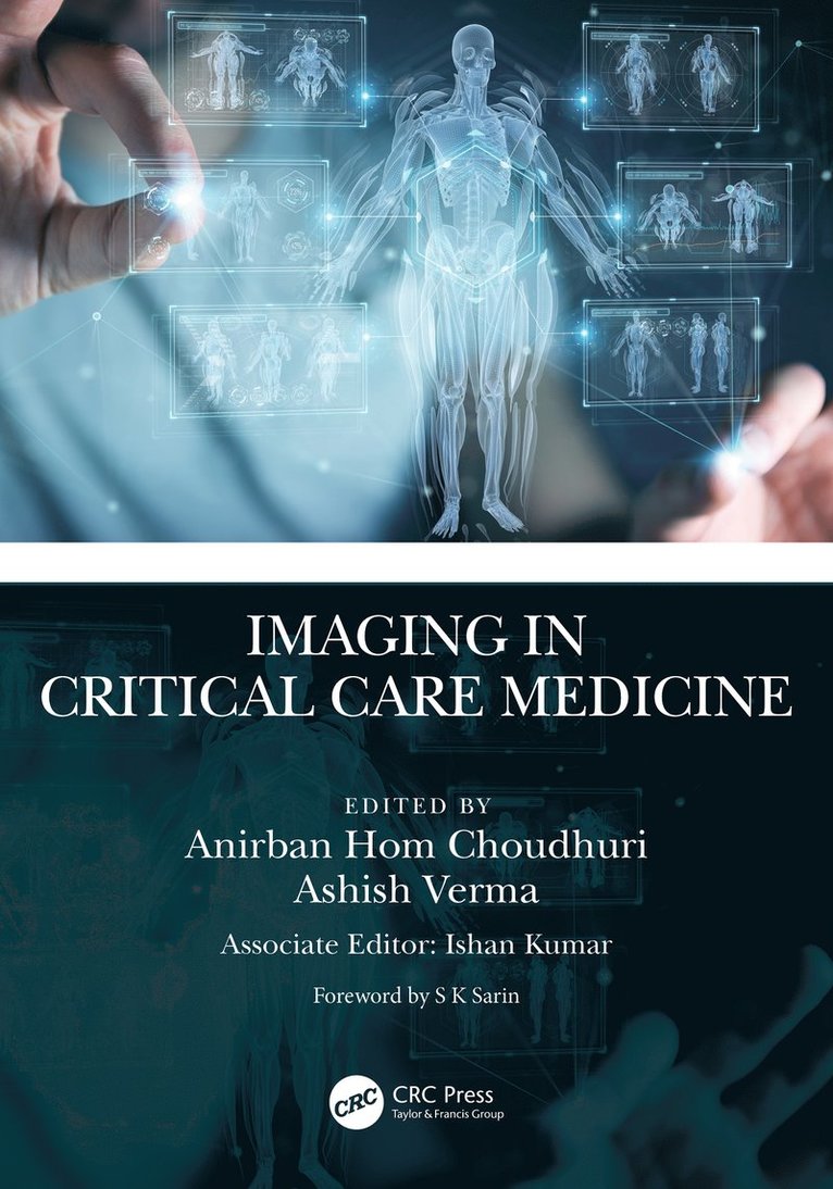 Anirban Hom Choudhuri, Ashish Verma, ND) Choudhuri, Anirban Hom (GIPMER, India) Verma, Ashish (IMS, BHU, Varanasi - Imaging in Critical Care Medicine, Häftad