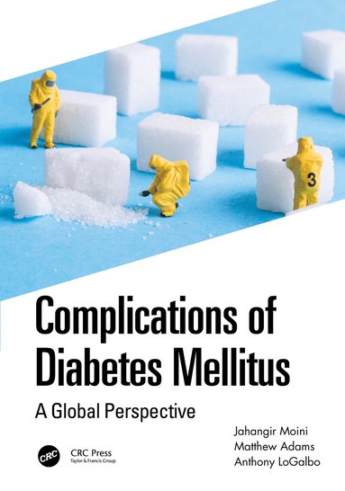 Jahangir Moini, Matthew Adams, Anthony LoGalbo - Complications of Diabetes Mellitus, Häftad
