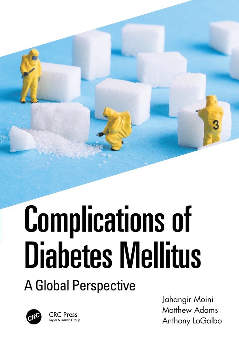 Jahangir Moini, Matthew Adams, Anthony LoGalbo, USA) Moini, Jahangir (Eastern Florida State College, USA) Adams, Matthew (Florida Eye Associates, Florida, USA) LoGalbo, Anthony (Florida Institute of Technology, Anthony Logalbo - Complications of Diabetes Mellitus, Häftad