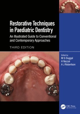 Restorative Techniques in Paediatric Dentistry 1