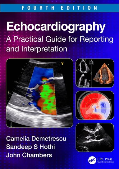 Camelia Demetrescu, Sandeep S. Hothi, John Chambers - Echocardiography, Häftad