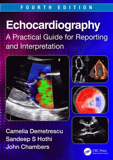 bokomslag Echocardiography