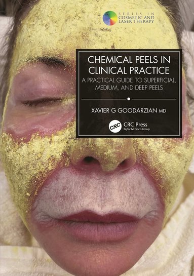 bokomslag Chemical Peels in Clinical Practice