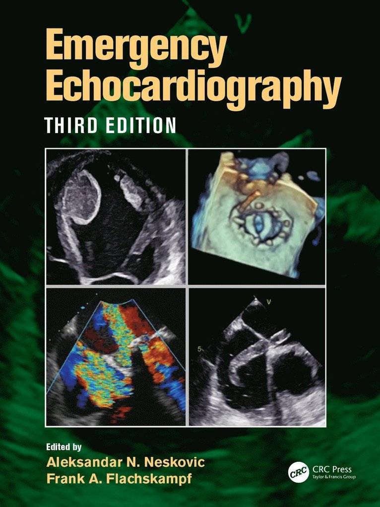 Emergency Echocardiography