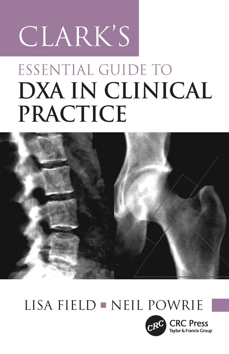 Clark's Essential Guide to DXA in Clinical Practice