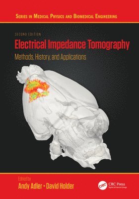 Electrical Impedance Tomography 1
