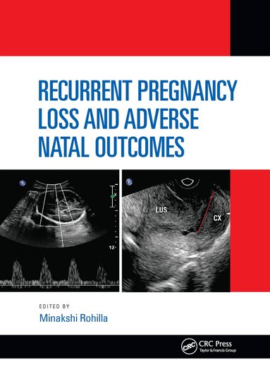 Minakshi Rohilla - Recurrent Pregnancy Loss and Adverse Natal Outcomes, Häftad