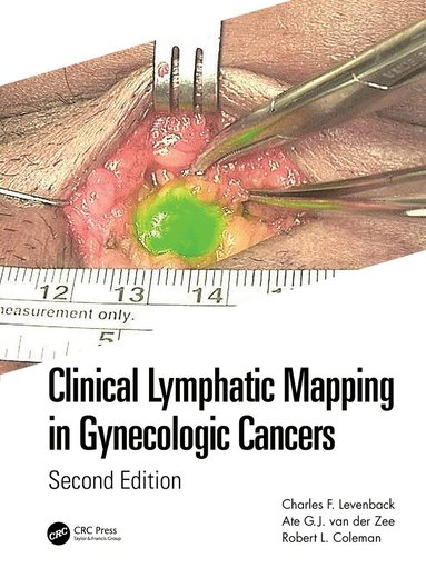 bokomslag Clinical Lymphatic Mapping in Gynecologic Cancers