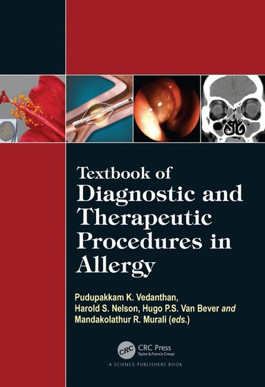 Pudupakkam K. Vedanthan, Harold S. Nelson, Hugo Van Bever, Mandakolathur R Murali - Textbook of Diagnostic and Therapeutic Procedures in Allergy, Inbunden