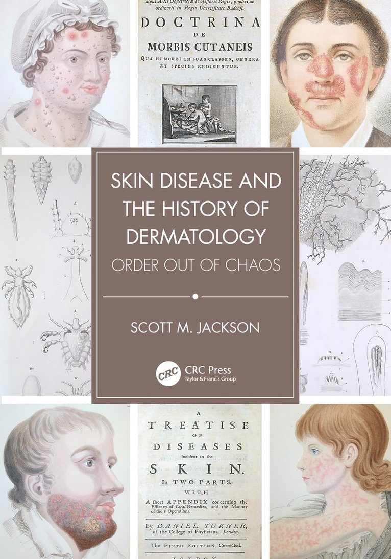 Skin Disease and the History of Dermatology 1