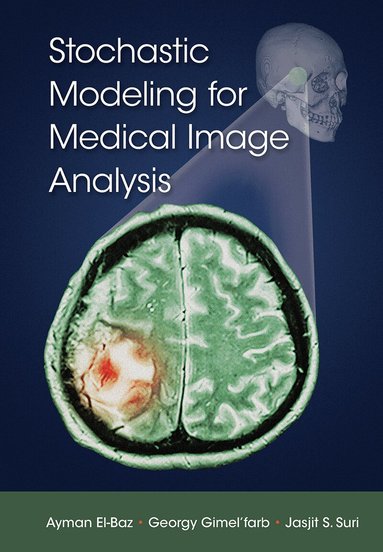 Ayman El-Baz, Georgy Gimel’farb, Jasjit S. Suri - Stochastic Modeling for Medical Image Analysis, Häftad