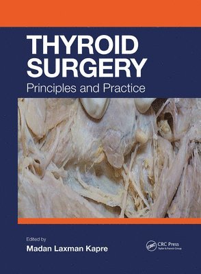 Thyroid Surgery 1